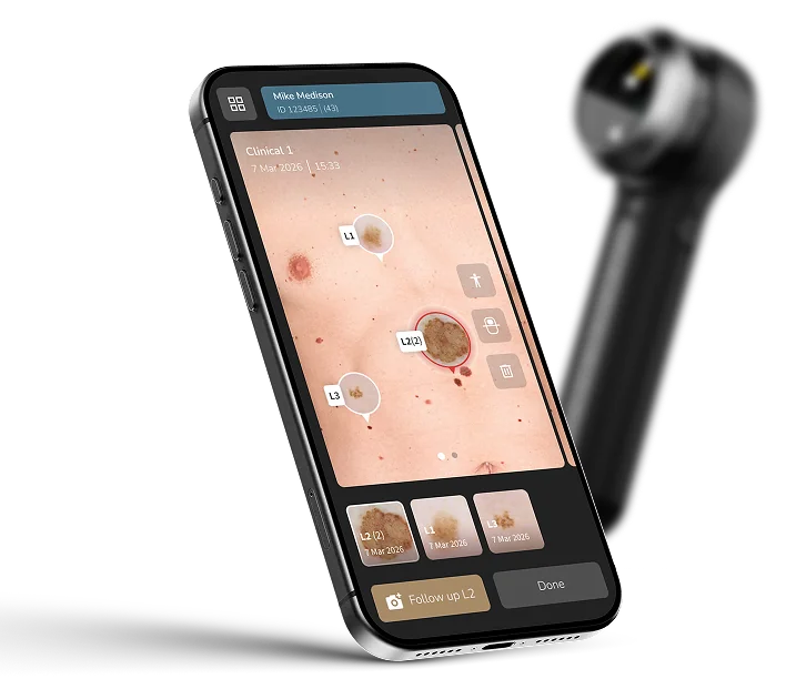Workflow Plus - DermLite DL5 Plus with Hub Cloud