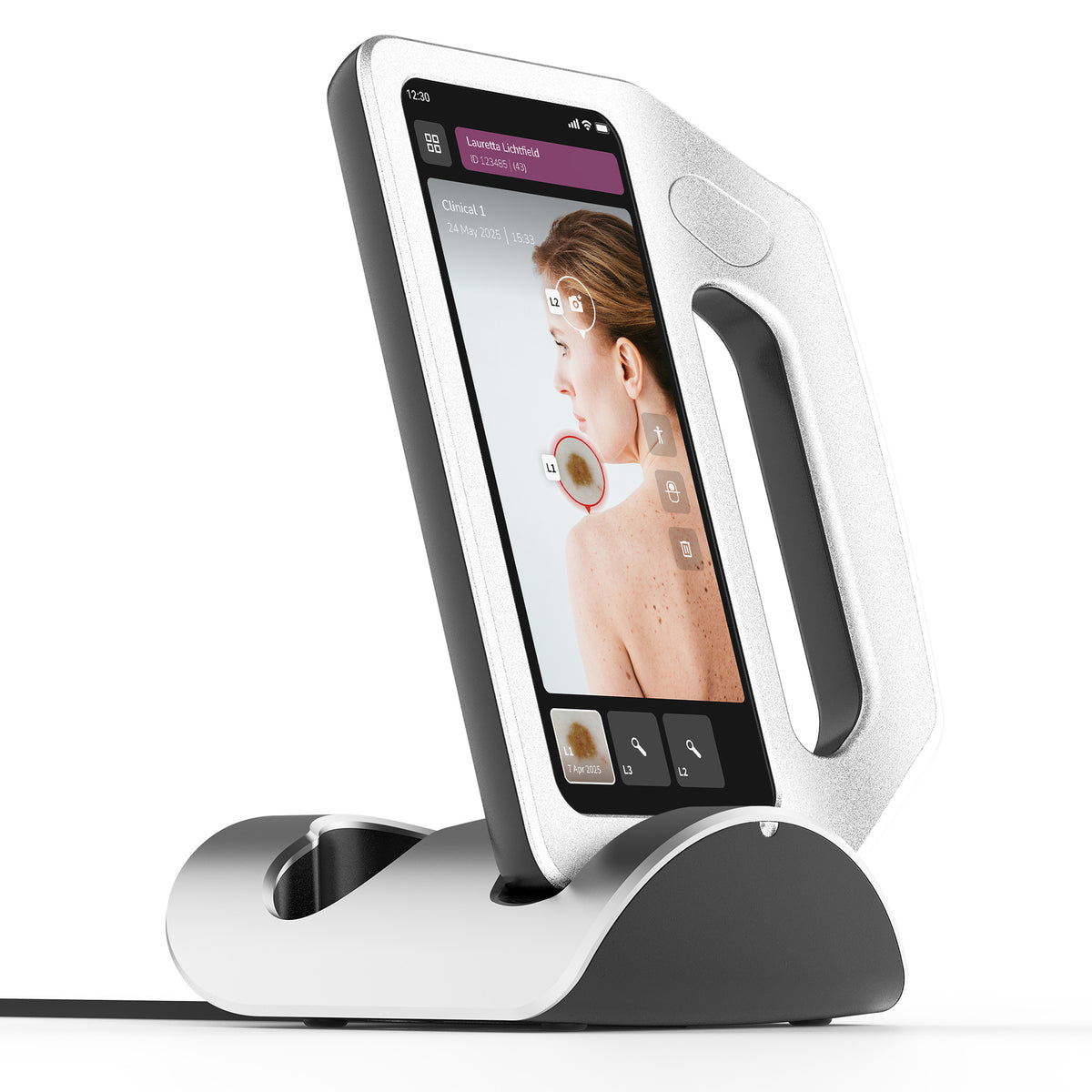 DermLite skeen handheld digital dermatoscope